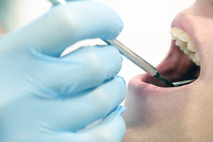 骨粗しょう症と歯周病との関係