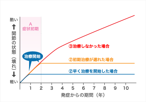 関節リウマチとは