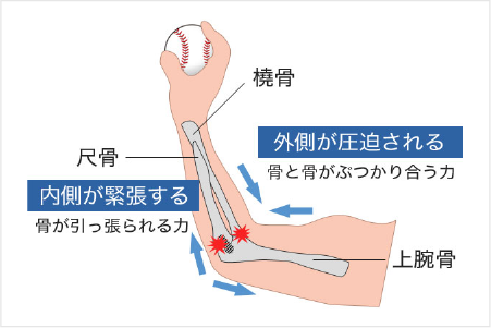 筋・腱の障害